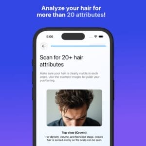 HIT1MILLION-Hairmaxx AI Hair Analysis: Lifetime Subscription (iOS only) for $39
